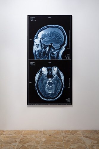 Brain-Inflation-2009-web_