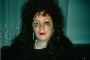 Nan Goldin, Autorretrato